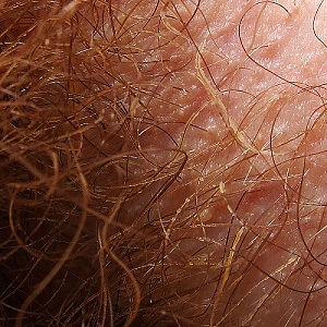 pubic hair