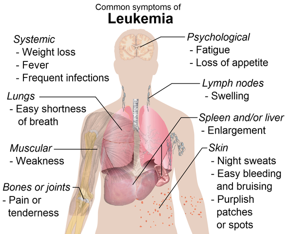 leukemia